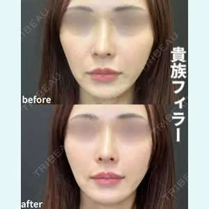 症例