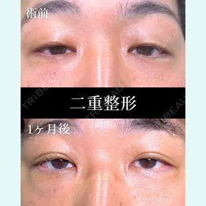 症例