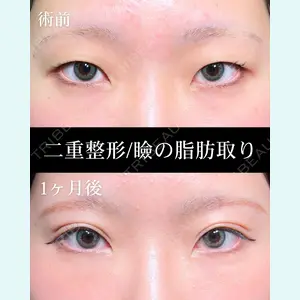 症例