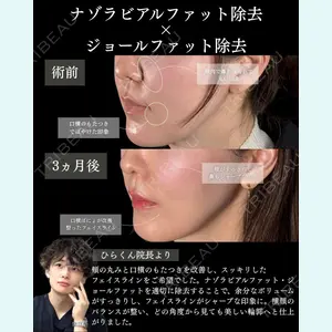 症例