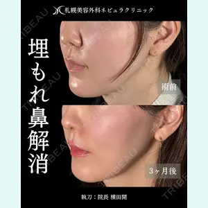 症例