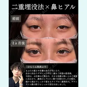 症例