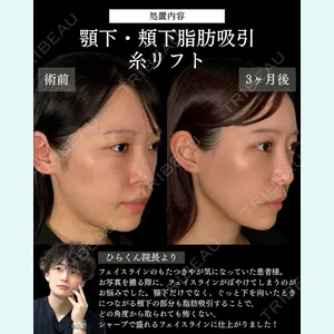 症例