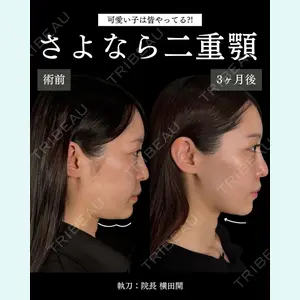 症例