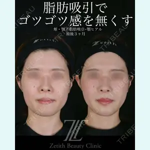 症例