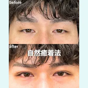 症例
