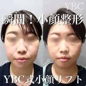 YBC横浜美容外科 大宮院 磯村 亮輔医師の症例