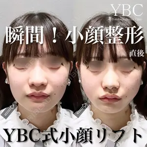 YBC横浜美容外科 大宮院 磯村 亮輔医師の症例