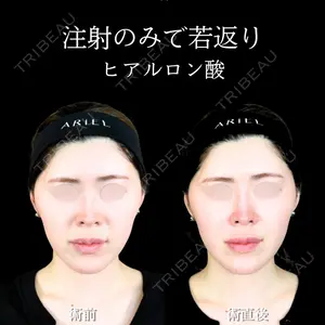 症例