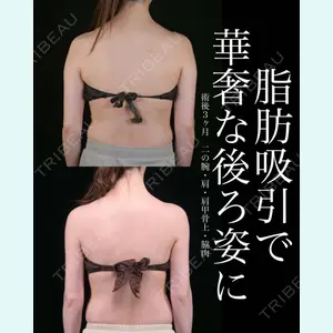 症例