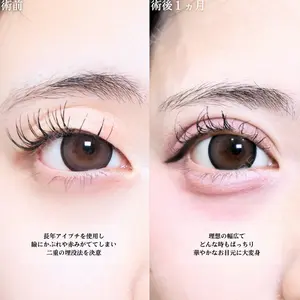 症例