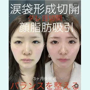 症例