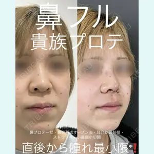 症例
