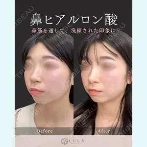 症例