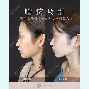 症例