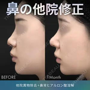 症例