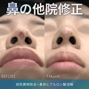 症例