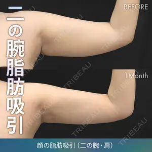 症例