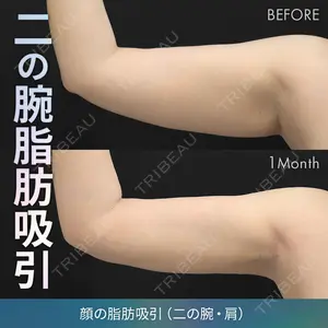 症例