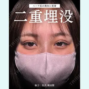症例