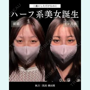 症例