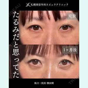 症例