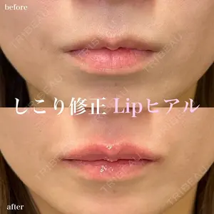 症例