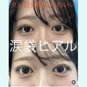 症例