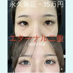 症例