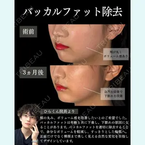 症例