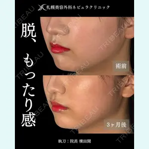 症例