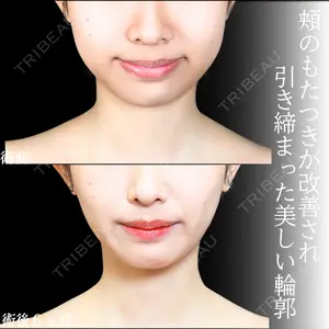 症例