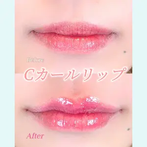 症例