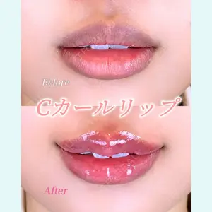 症例