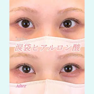 症例
