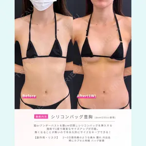 症例