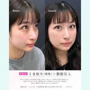 症例