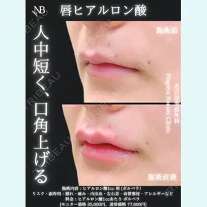 症例