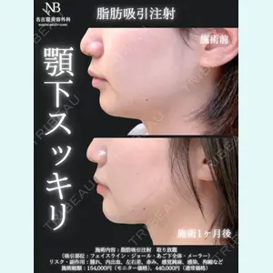 症例