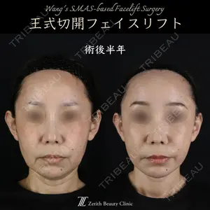 症例