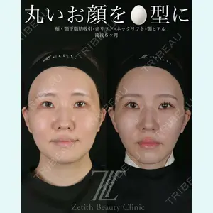 症例