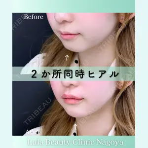 症例