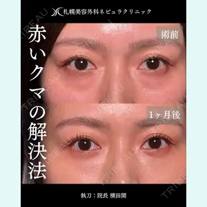 症例