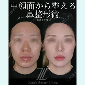 症例