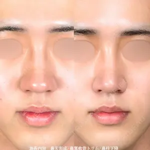 症例