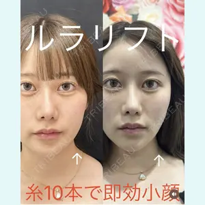 症例