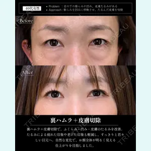 症例
