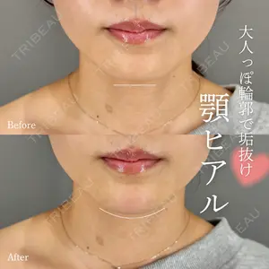 症例
