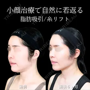 症例