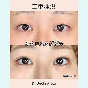 症例